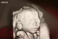 Seth-02-25-2020